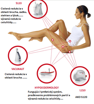 Hypoxi